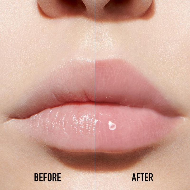 lips maximizer